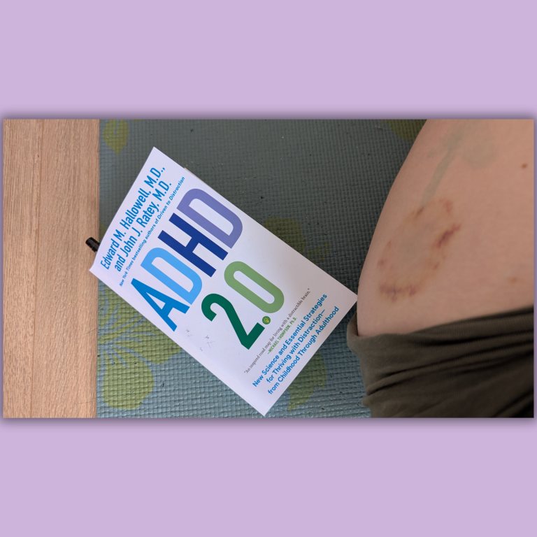 adhd 2.0 book next to a bruised leg